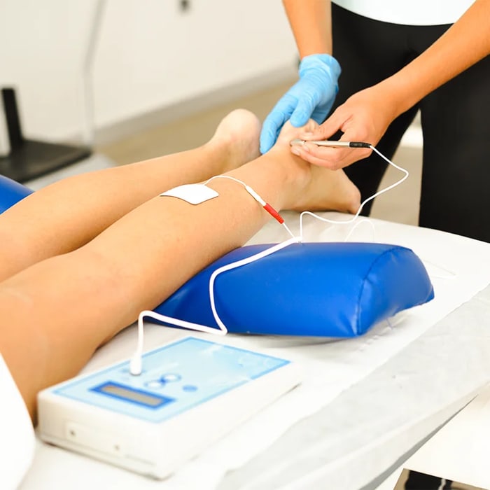 Electrical stimulation therapy electrodes applied to a patient’s lower leg